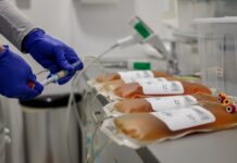 Zenével és esti programokkal várják a plazmaadókat Pécsett